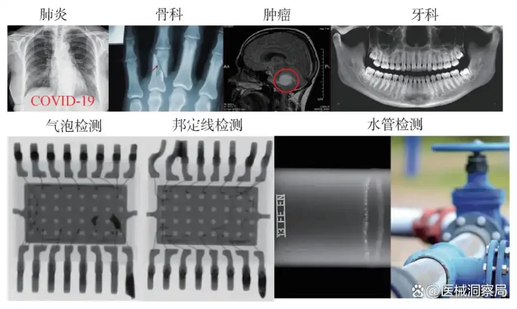 X射线成像技术广泛应用于医学诊断及工业无损探测等领域
